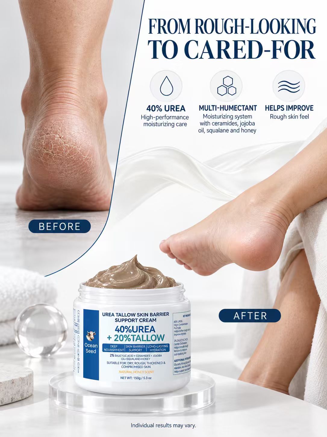 Ocean Seed Urea Tallow Skin Barrier Support Cream 40% Urea 20% Tallow for Dry Rough Thickened Skin 150g