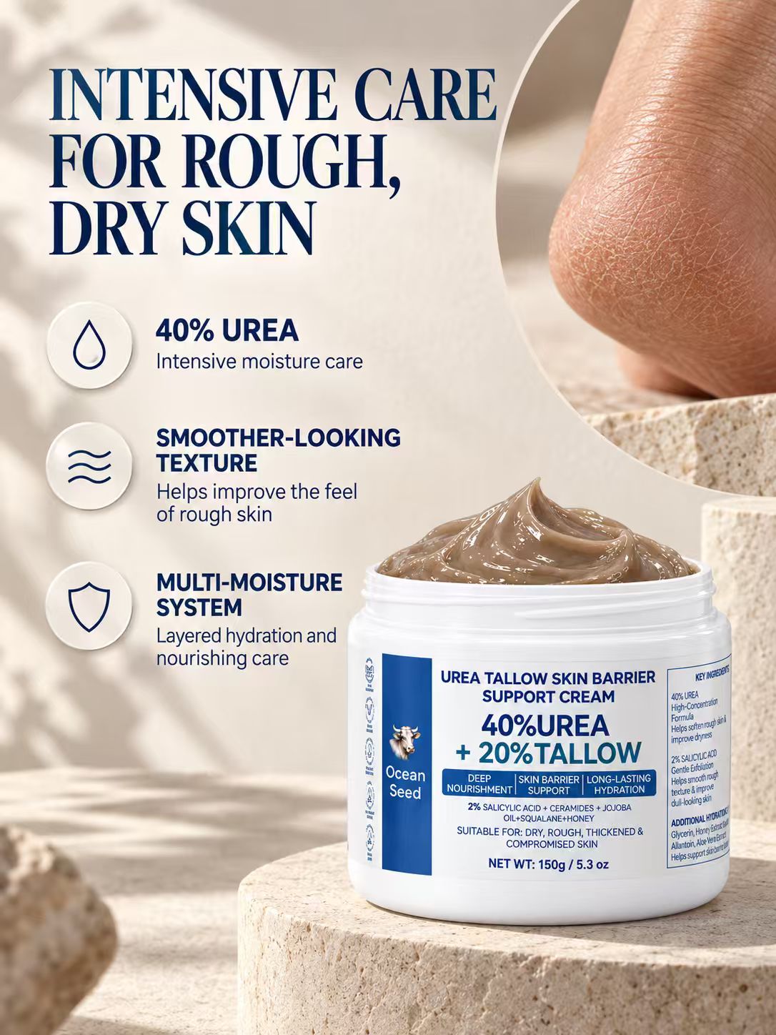 Ocean Seed 40% Urea + 20% Tallow Cream, Skin Barrier Support Moisturizer with Salicylic Acid, Ceramides, Jojoba Oil & Squalane, for Dry Rough Skin, 150g
