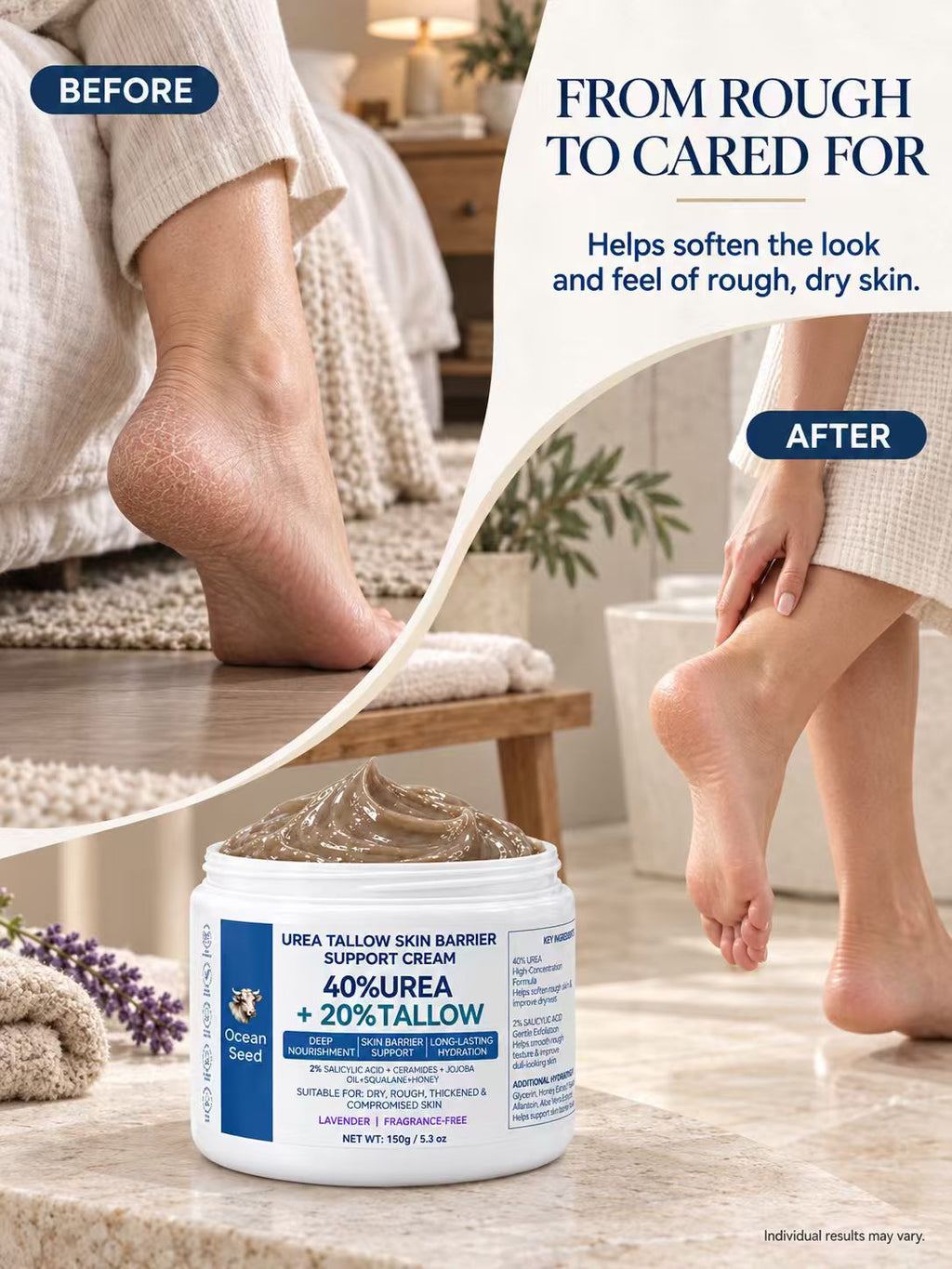 Ocean Seed 40% Urea + 20% Tallow Cream, Skin Barrier Support Moisturizer with Salicylic Acid, Ceramides, Jojoba Oil & Squalane, for Dry Rough Skin, 150g