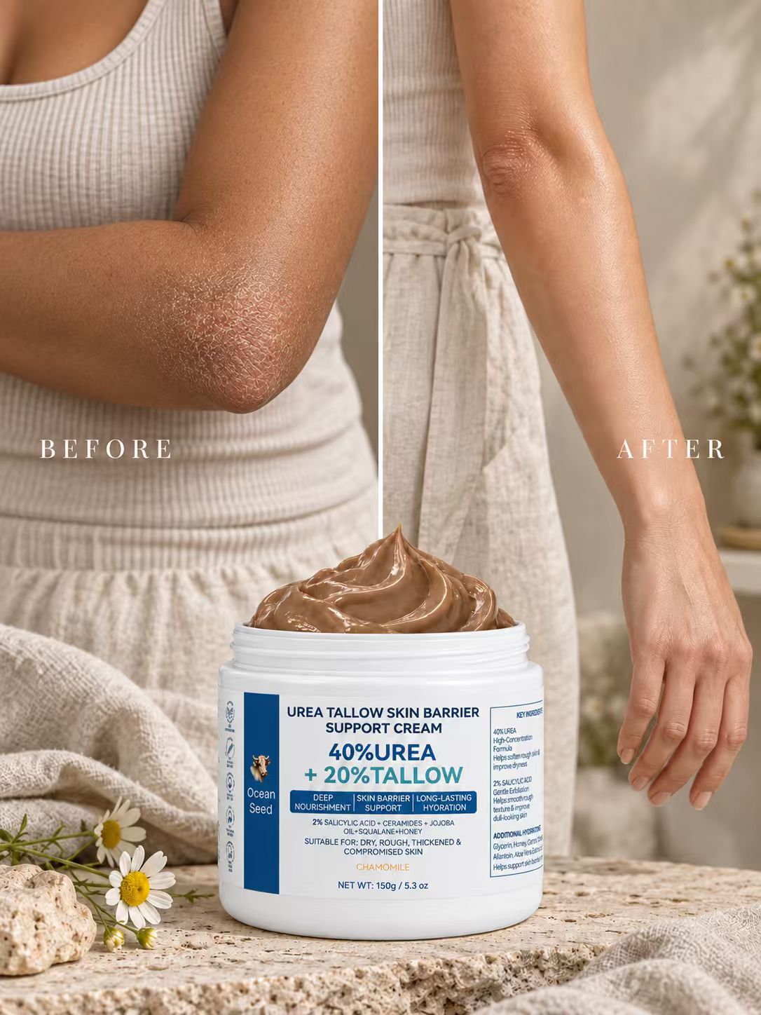 Ocean Seed 40% Urea Cream with 20% Tallow & 2% Salicylic Acid, Foot Cream for Dry Cracked Heels, Rough Skin & Callus, Moisturizing Skin Barrier Repair Balm for Hands Body, 5.3oz